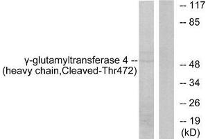 Western blot analysis of extracts from Jurkat cells, treated with etoposide (25uM, 24hours), using Gamma-glutamyltransferase 4 (heavy chain, Cleaved-Thr472) antibody. (GGT7 antibody  (Internal Region))
