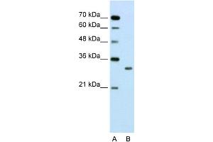 WB Suggested Anti-SBDS Antibody Titration:  2. (SBDS antibody  (N-Term))