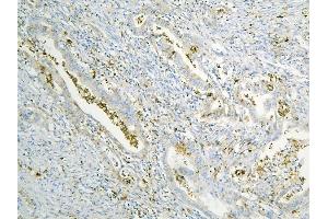 IHC analysis of ANXA3 using anti-ANXA3 antibody (ABIN6719269). (Annexin A3 antibody  (AA 23-323))
