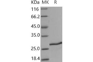 Western Blotting (WB) image for Stromal Cell Derived Factor 2 (SDF2) protein (His tag) (ABIN7320352)