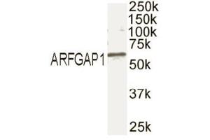 Western blot analysis of ARFGAP1 in mouse brain extract with ABIN121678. (RHOU antibody  (C-Term))