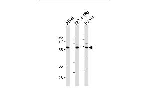 All lanes : Anti-Dsiglec-W20 at 1:2000 dilution Lane 1: A549 whole cell lysate Lane 2: NCI- whole cell lysate Lane 3: Human liver lysate Lysates/proteins at 20 μg per lane. (SIGLEC7 antibody  (N-Term))