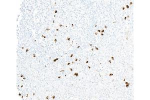 Immunohistochemistry (IHC) image for anti-Chemokine (C-X3-C Motif) Receptor 1 (CX3CR1) (AA 300-350) antibody (ABIN7795802)