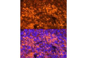 Immunofluorescence analysis of Mouse spleen using CCL5/RANTES antibody (ABIN6129369, ABIN6138063, ABIN6138065 and ABIN6218473) at dilution of 1:100. (CCL5 antibody  (AA 24-91))