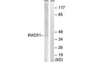 Western blot analysis of extracts from NIH-3T3 cells, treated with starved 24h, using RAD51 (Ab-309) Antibody. (RAD51 antibody  (AA 275-324))