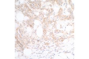 anti-Poliovirus Receptor-Related 2 (Herpesvirus Entry Mediator B) (PVRL2) (AA 50-100) antibody