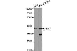 Western blot analysis of extracts of various cell lines, using UBIAD1 antibody (ABIN6293616) at 1:500 dilution. (UBIAD1 antibody)