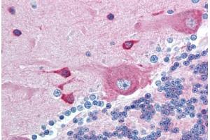 Human Brain, Cerebellum (formalin-fixed, paraffin-embedded) stained with PACSIN2 antibody ABIN293028 at 10 ug/ml followed by biotinylated goat anti-rabbit IgG secondary antibody ABIN481713, alkaline phosphatase-streptavidin and chromogen. (PACSIN2 antibody  (AA 400-450))