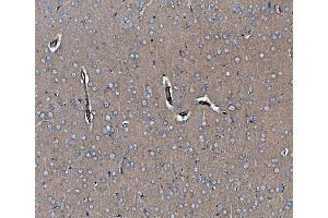 IHC analysis of EHD3 using anti-EHD3 antibody (ABIN7602777). (EHD3 antibody  (C-Term))