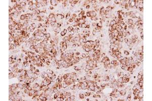 IHC-P Image Immunohistochemical analysis of paraffin-embedded MCF7 xenograft, using TST, antibody at 1:250 dilution. (TST antibody)