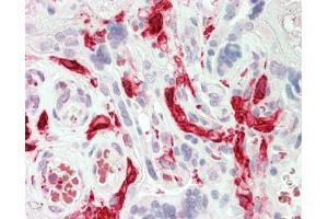 Human Placenta: Formalin-Fixed, Paraffin-Embedded (FFPE) (F13A1 antibody  (N-Term))