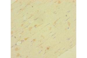 Immunohistochemistry of paraffin-embedded human skeletal muscle tissue using ABIN7158146 at dilution of 1:100 (LRRC19 antibody  (AA 25-270))