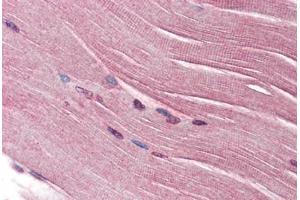 Human Skeletal Muscle (formalin-fixed, paraffin-embedded) stained with SH3GLB1 antibody ABIN334268 at 2. (SH3GLB1 antibody)