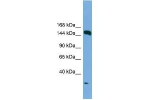 WB Suggested Anti-EEA1 Antibody Titration: 0. (EEA1 antibody  (N-Term))