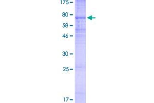 KCNJ11 Protein (AA 1-390) (GST tag)