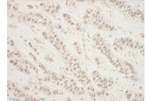 Immunohistochemistry (IHC) image for anti-Folliculin (FLCN) (AA 1-50) antibody (ABIN7454827)