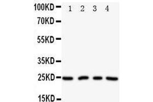 Anti-NPM2 antibody, Western blotting Lane 1: HELA Cell Lysate Lane 2: U87 Cell Lysate Lane 3: A549 Cell Lysate Lane 4: SMMC Cell Lysate (NPM2 antibody  (N-Term))