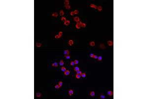 Immunofluorescence analysis of Neuro-2a cells using TrkB Rabbit pAb (ABIN3022911, ABIN3022912, ABIN3022913 and ABIN6219292) at dilution of 1:150 (40x lens). (TRKB antibody  (AA 32-282))