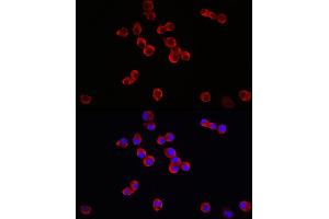 Immunofluorescence analysis of Neuro-2a cells using TrkB Rabbit pAb (ABIN3022911, ABIN3022912, ABIN3022913 and ABIN6219292) at dilution of 1:150 (40x lens). (TRKB antibody  (AA 32-282))