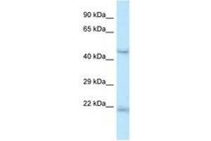 Image no. 1 for anti-One Cut Homeobox 1 (ONECUT1) (AA 370-419) antibody (ABIN6747414) (ONECUT1 antibody  (AA 370-419))