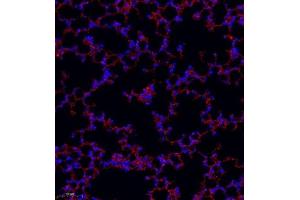 Immunofluorescence of paraffin embedded mouse lung using MRP1 (ABIN7074544) at dilution of 1:1000 (250x lens) (Multidrug-Resistance Like Protein 1 antibody)