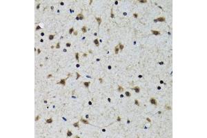 Immunohistochemistry of paraffin-embedded rat brain using SLC23A2 antibody (ABIN5974077) at dilution of 1/100 (40x lens). (SLC23A2 antibody)
