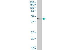 SMAD7 monoclonal antibody (M06), clone 4E1 Western Blot analysis of SMAD7 expression in HeLa . (SMAD7 antibody  (AA 160-260))