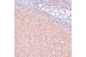 Immunohistochemistry of paraffin-embedded rat ovary using K antibody (ABIN7268147) at dilution of 1:100 (40x lens). (KANK2 antibody  (AA 1-300))