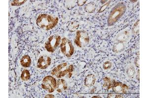 Immunoperoxidase of monoclonal antibody to TLN1 on formalin-fixed paraffin-embedded human stomach. (TLN1 antibody  (AA 1052-1149))