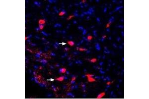 Expression of KCNK2 (TREK-1) in rat midbrain - Immunohistochemical staining of perfusion-fixed frozen rat brain sections using Guinea pig Anti-KCNK2 (TREK-1) Antibody (ABIN7043451, ABIN7045404 and ABIN7045405), (1:400), followed by goat-anti-guinea pig-Cy3 antibody. (KCNK2 antibody  (Intracellular, N-Term))