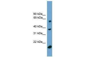 TBL1Y antibody used at 0.