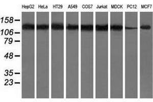 Western blot analysis of extracts (35 µg) from 9 different cell lines by using anti-HDAC6 monoclonal antibody. (HDAC6 antibody)