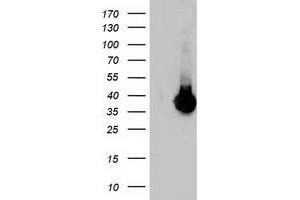 Western Blotting (WB) image for anti-Low Density Lipoprotein Receptor Adaptor Protein 1 (LDLRAP1) antibody (ABIN1496688) (LDLRAP1 antibody)