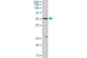 PFKFB3 MaxPab rabbit polyclonal antibody. (PFKFB3 antibody  (AA 1-520))