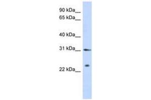 Image no. 1 for anti-Synovial Sarcoma, X Breakpoint 5 (SSX5) (AA 143-192) antibody (ABIN6742633) (SSX5 antibody  (AA 143-192))
