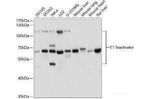 Western blot analysis of extracts of various cell lines using C1 Inactivator Polyclonal Antibody at dilution of 1:1000. (SERPING1 antibody)