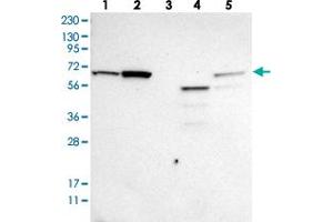 Western blot analysis of Lane 1: RT-4, Lane 2: U-251 MG, Lane 3: Human Plasma, Lane 4: Liver, Lane 5: Tonsil with ME2 polyclonal antibody  at 1:250-1:500 dilution. (NAD-ME antibody)
