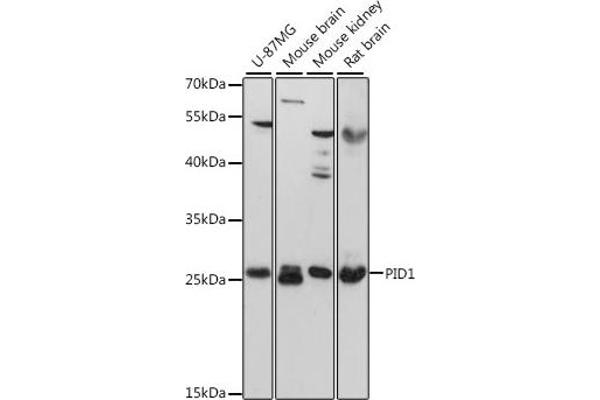 PID1 anticorps  (AA 124-248)