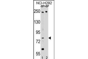 Western blot analysis of PL2 Antibody (N-term) Pab 17460a pre-incubated without(lane 1) and with(lane 2) blocking peptide in NCI- cell line lysate. (APPL2 antibody  (N-Term))