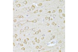 Immunohistochemistry of paraffin-embedded rat brain using FDPS Antibody. (FDPS antibody  (AA 120-419))