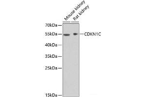 Western blot analysis of extracts of various cell lines using CDKN1C Polyclonal Antibody at dilution of 1:1000. (CDKN1C antibody)