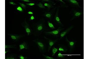Immunofluorescence of purified MaxPab antibody to PPP1CC on HeLa cell. (PPP1CC antibody  (AA 1-323))