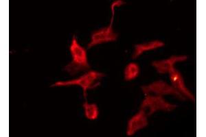 ABIN6274671 staining NIH-3T3 by IF/ICC. (GRID2 antibody  (C-Term))