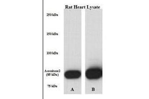 Perfused isolated rat heart whole tissue lysate was lysed with either A) 50 mM Tris-HCl, 150 mM NaCl, 1 mM EDTA, 1 % NP-40, 0. (ACO2 antibody  (AA 438-467))