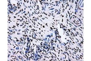 Immunohistochemical staining of paraffin-embedded Ovary tissue using anti-RALBP1mouse monoclonal antibody. (RALBP1 antibody)