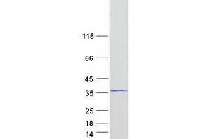 Four and A Half LIM Domains 1 (FHL1) (Transcript Variant 3) protein (Myc-DYKDDDDK Tag)