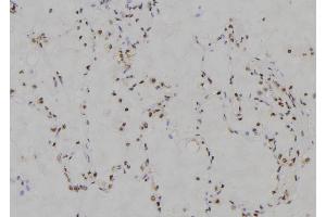 ABIN6274221 at 1/100 staining Human lung tissue by IHC-P. (MZF1 antibody  (N-Term))