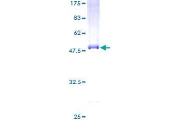 CLEC3B Protein (AA 1-202) (GST tag)