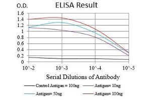 Black line: Control Antigen (100 ng), Purple line: Antigen(10 ng), Blue line: Antigen (50 ng), Red line: Antigen (100 ng), (ZEB1 antibody  (AA 967-1108))