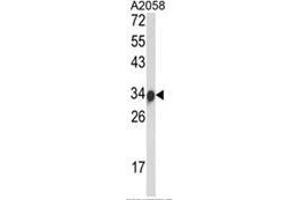 Western blot analysis of IGH Antibody (C-Term) in A2058 cell line lysates (35ug/lane). (IgH antibody  (C-Term))